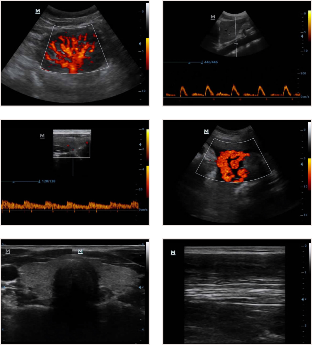 Mindray DP30Vet Power | Advanced Veterinary Ultrasound System - Echomedic Mindray DP30 Vet Power veterinaire echografie met Power Doppler voor reproductieonderzoek bij paarden en abdominale diagnostiek bij kleine huisdieren