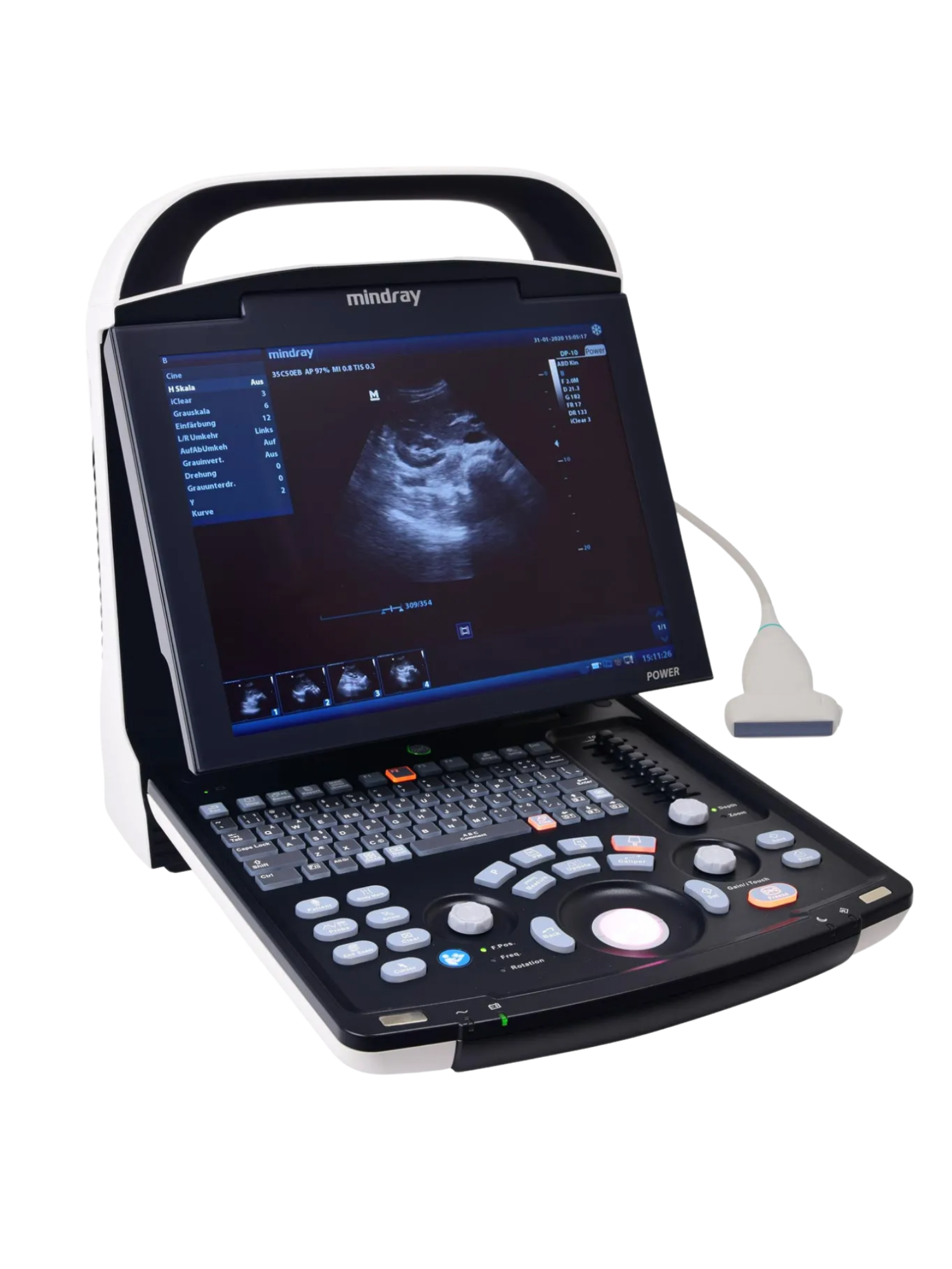 Mindray DP30Vet Power | Advanced Veterinary Ultrasound System - Echomedic Mindray DP30 Vet Power veterinaire echografie met Power Doppler voor reproductieonderzoek bij paarden en abdominale diagnostiek bij kleine huisdieren