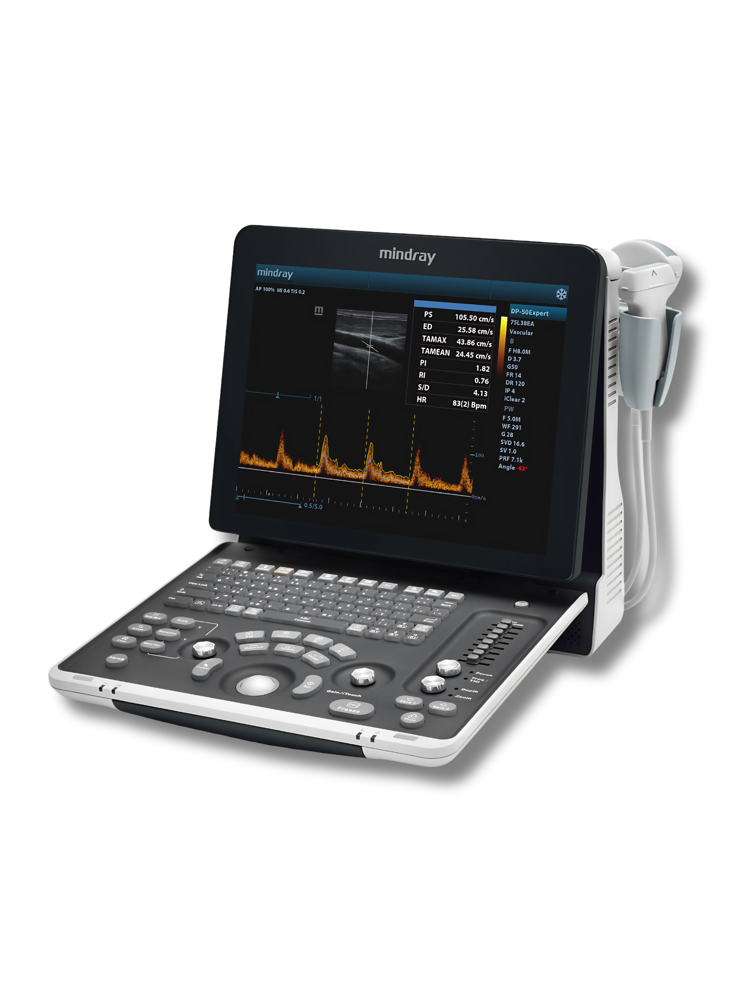 Mindray DP50Exp Vet | Portable Veterinary Ultrasound System - Echomedic Mindray DP50 Vet Exp draagbare veterinaire echografie met upgrade naar Color en Power Doppler voor diagnostiek bij gezelschapsdieren en paarden