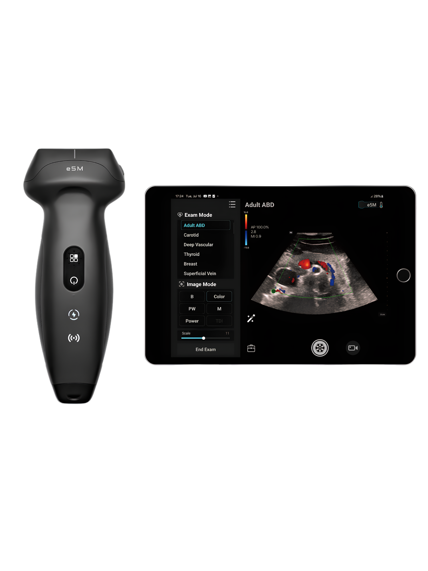 Mindray TE Air e5M draadloos handheld veterinair echografietoestel met convex- en lineaire probe voor spoed, POCUS en FAST-scans bij paarden en gezelschapsdieren