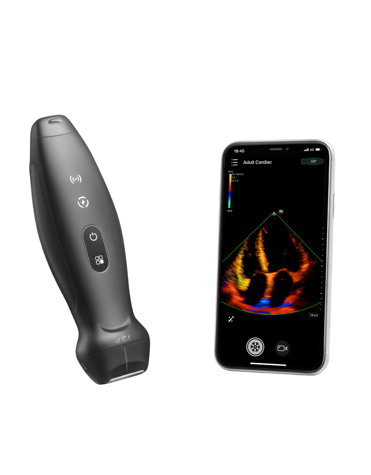 led marketing screen glass Mindray TE Air i3P draadloze phased array probe voor spoed, IC, peri-operatieve diagnostiek en FAST-scans bij gezelschapsdieren en paarden