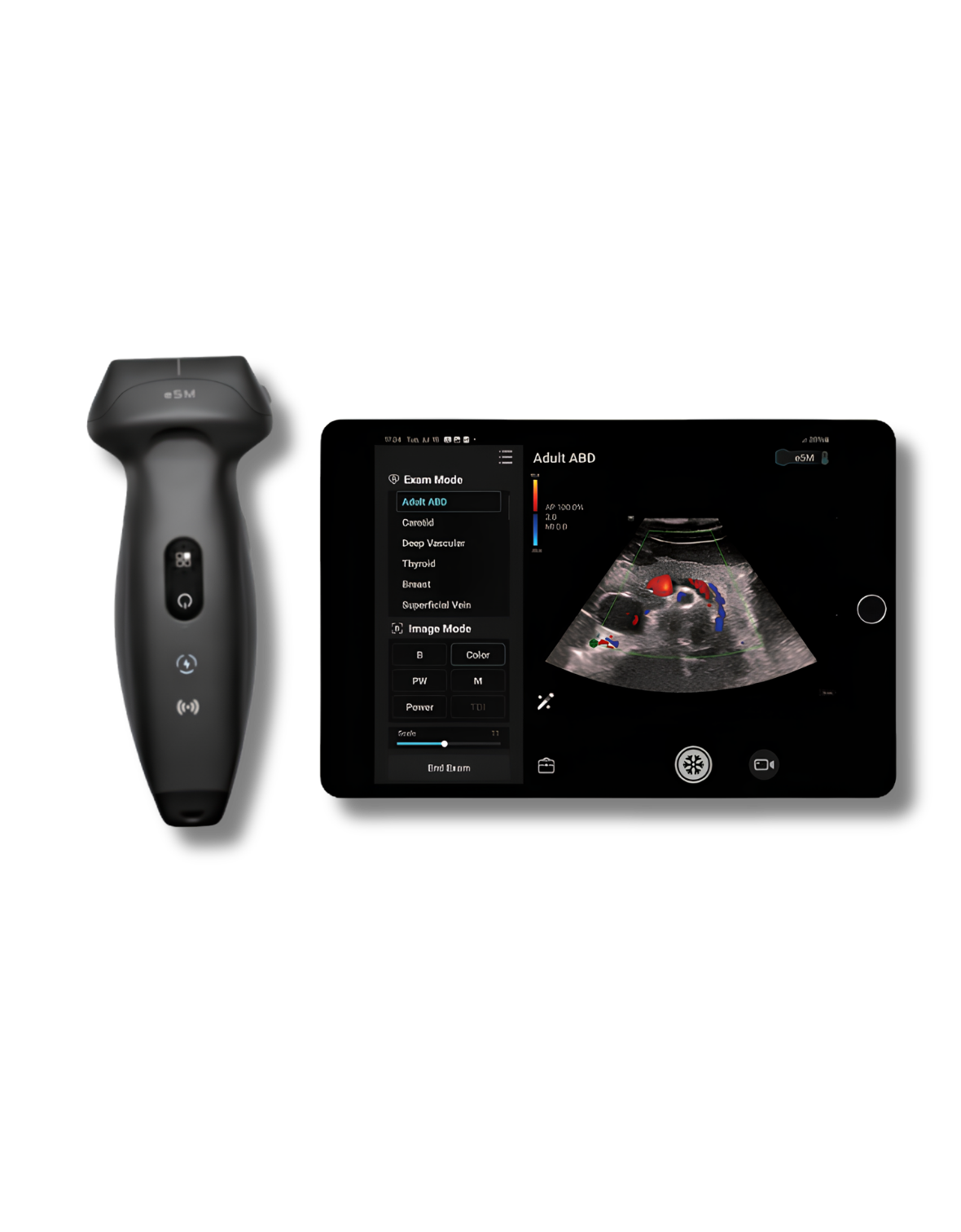 Mindray TE Air e5M draadloos handheld veterinair echografietoestel met convex- en lineaire probe voor spoed, POCUS en FAST-scans bij paarden en gezelschapsdieren