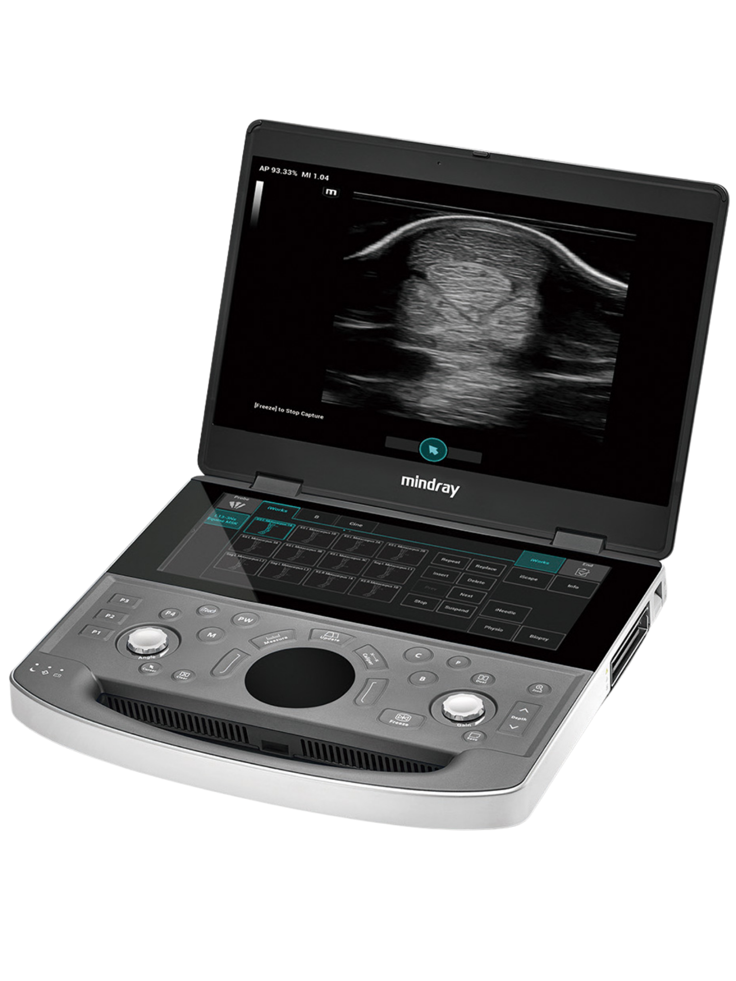 Mindray Vetus EQ draagbaar veterinair echografietoestel voor gynaecologische, pees- en abdominale onderzoeken bij paarden