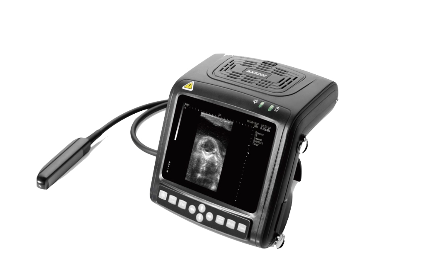 Echomedic KX5200