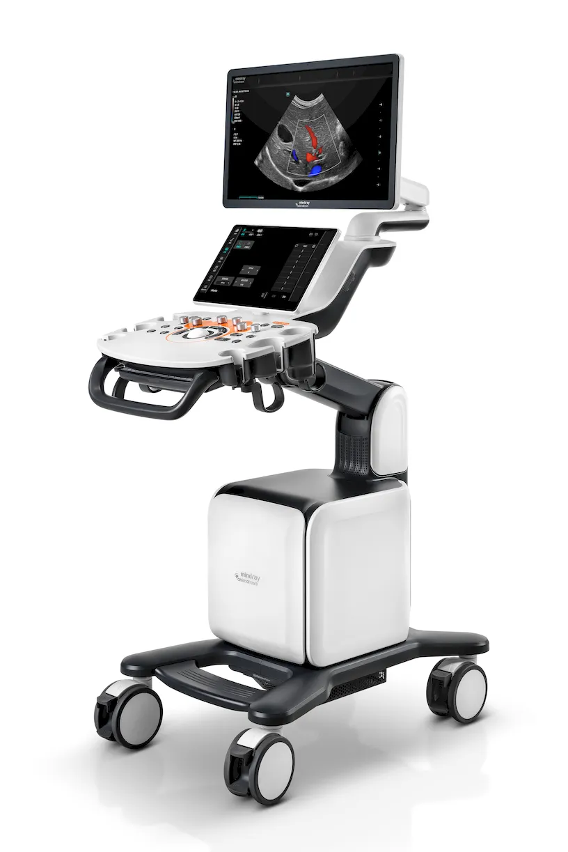 De Vetus Nova combineert sterke abdominale beeldkwaliteit met moderne technologie en gebruiksgemak – aan een scherpe prijs. Ideaal voor startende echografisten en dierenartsen die complete abdominale onderzoeken willen uitvoeren zonder te investeren in functies die ze niet nodig hebben.