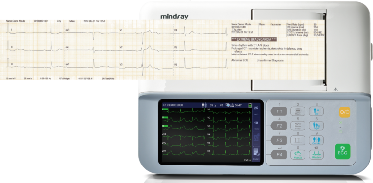 Mindray BeneHeart R3 Vet ECG