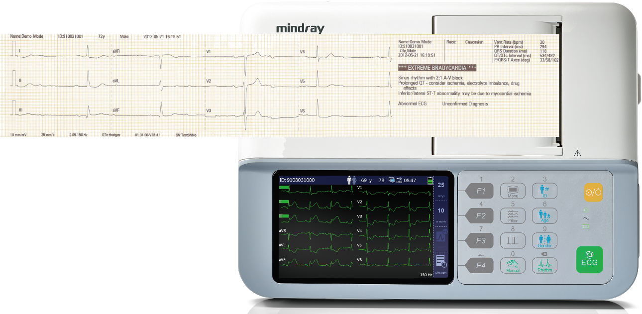 Mindray BeneHeart R3 Vet veterinair ECG-toestel