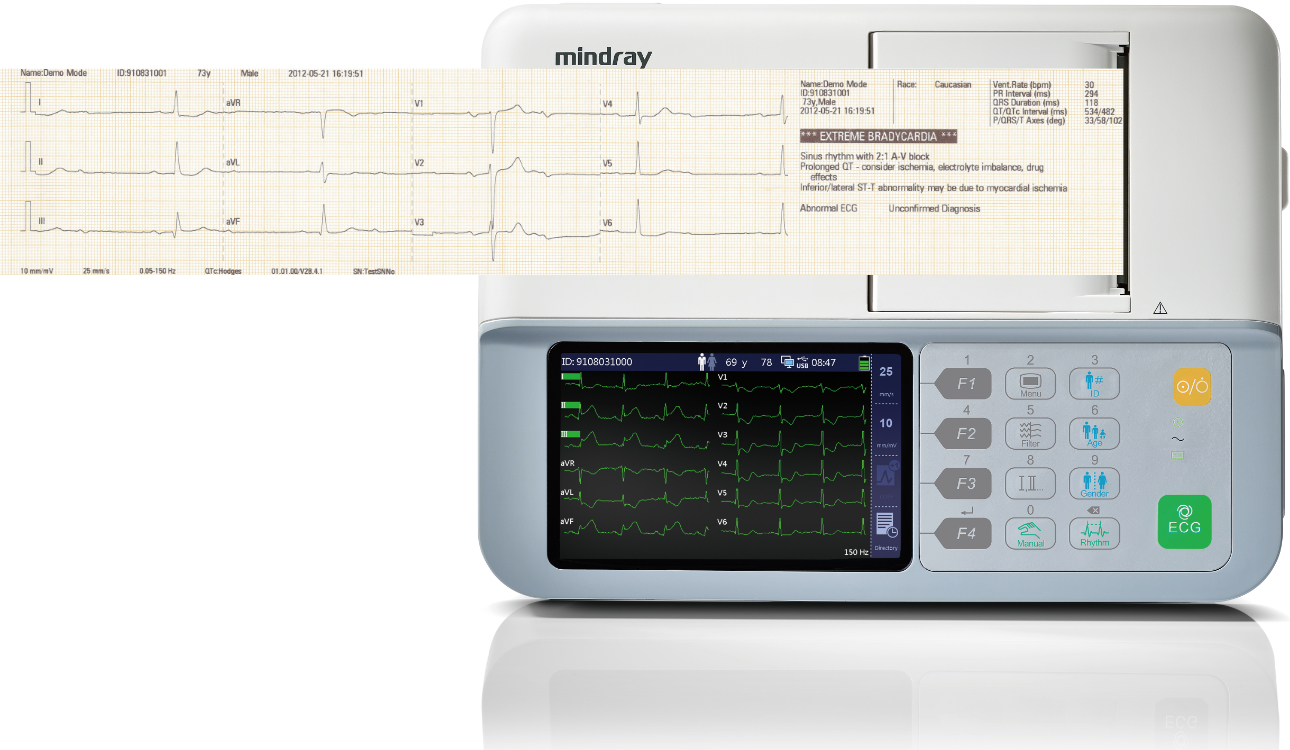 Mindray BeneHeart R3 Vet Mindray BeneHeart R3 Vet veterinair ECG-toestel