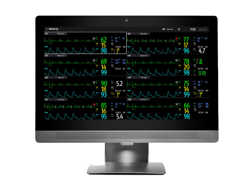 De Mindray BeneVision CMS Vet brengt de gegevens van alle aangesloten monitoren samen in één centraal overzicht, met CentralStation, WorkStation, ViewStation, CMS Viewer en Mobile Viewer. Voor IC, OK, recovery en hospitalisatie.