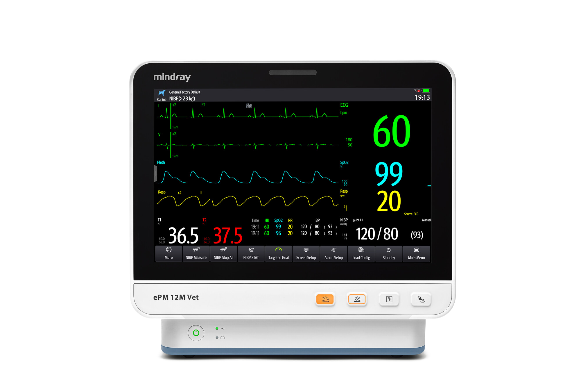 Mindray ePM 12M Vet Mindray ePM 12M Vet veterinaire patiëntmonitor