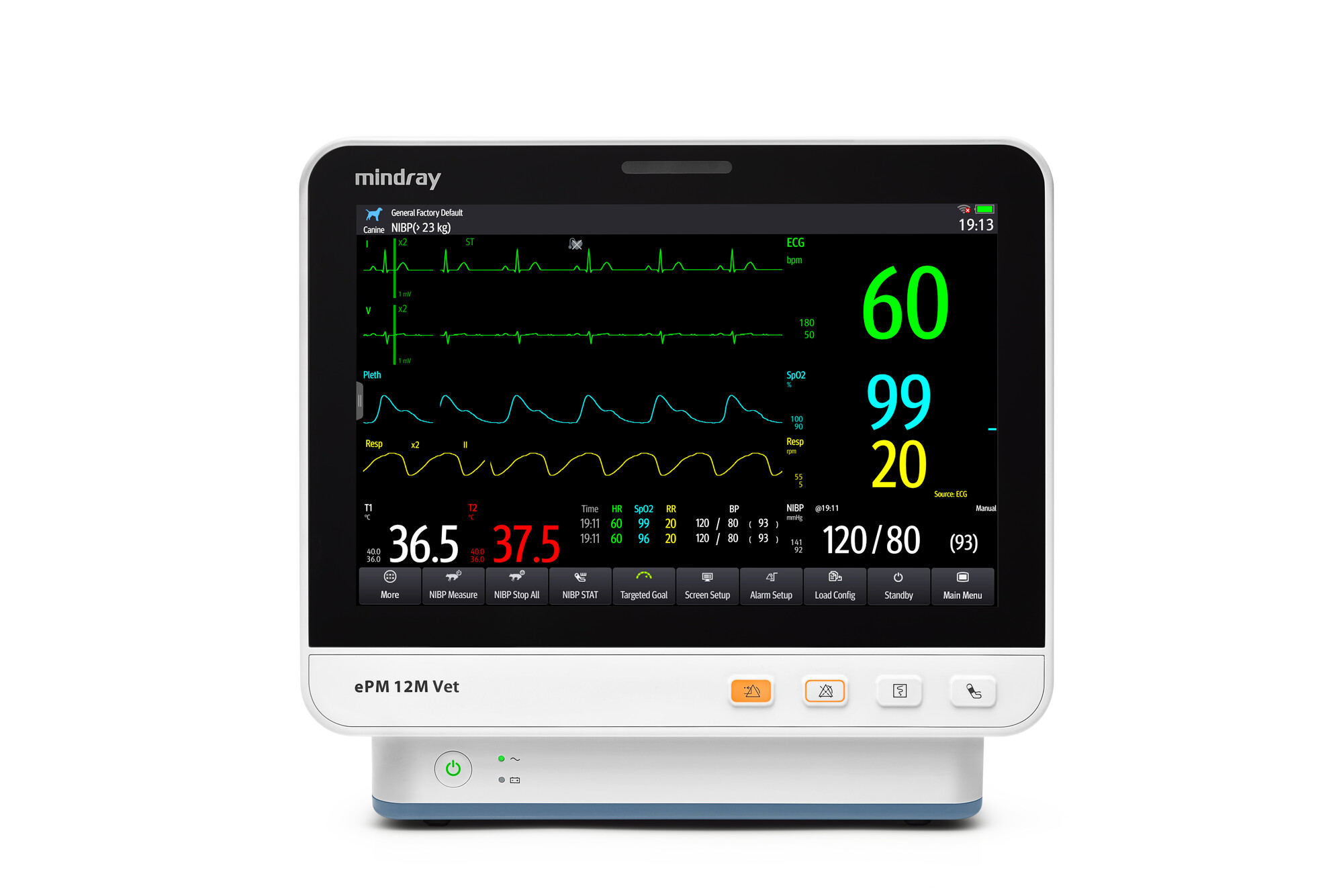 Mindray ePM 12M Vet Mindray ePM 12M Vet veterinaire patiëntmonitor
