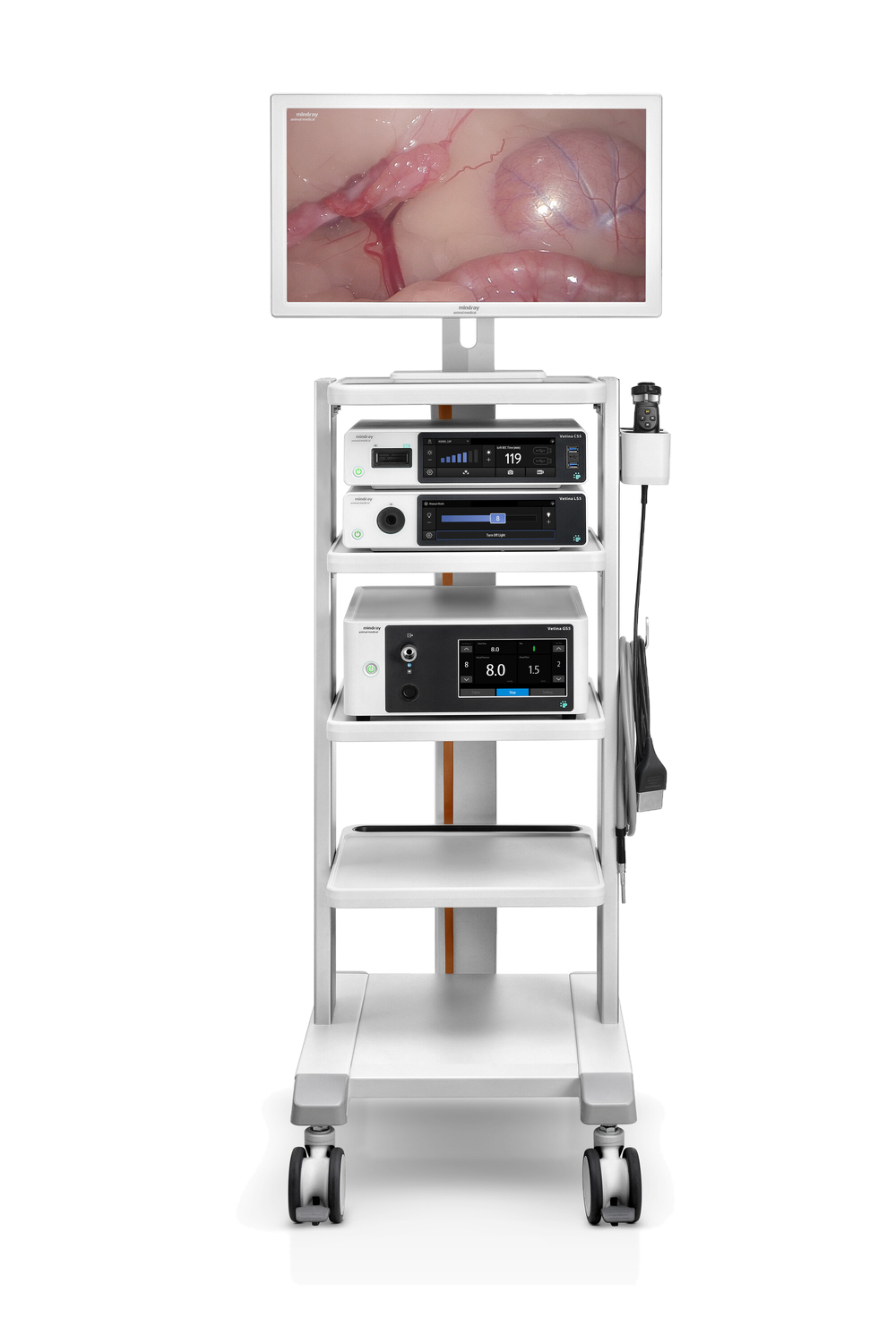 De Mindray Vetina CS5 is een endoscopieplatform voor minimaal invasieve chirurgie in native 4K, met One-Click Autofocus en een insufflator met dierspecifieke presets. Beschikbaar als CS5 en als CS5 Ultra met 32-inch scherm en verwarmde CO₂.