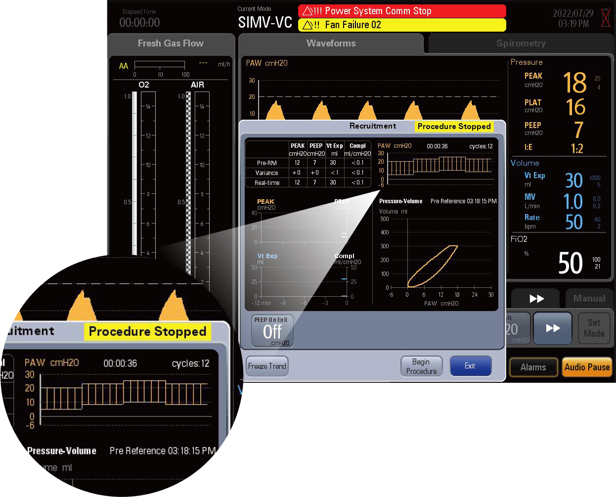 Mindray WATO EX-65 Pro Vet Mindray WATO EX-65 Pro Vet anesthesietoestel — detailbeeld