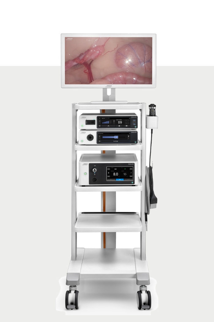 Endoscopie